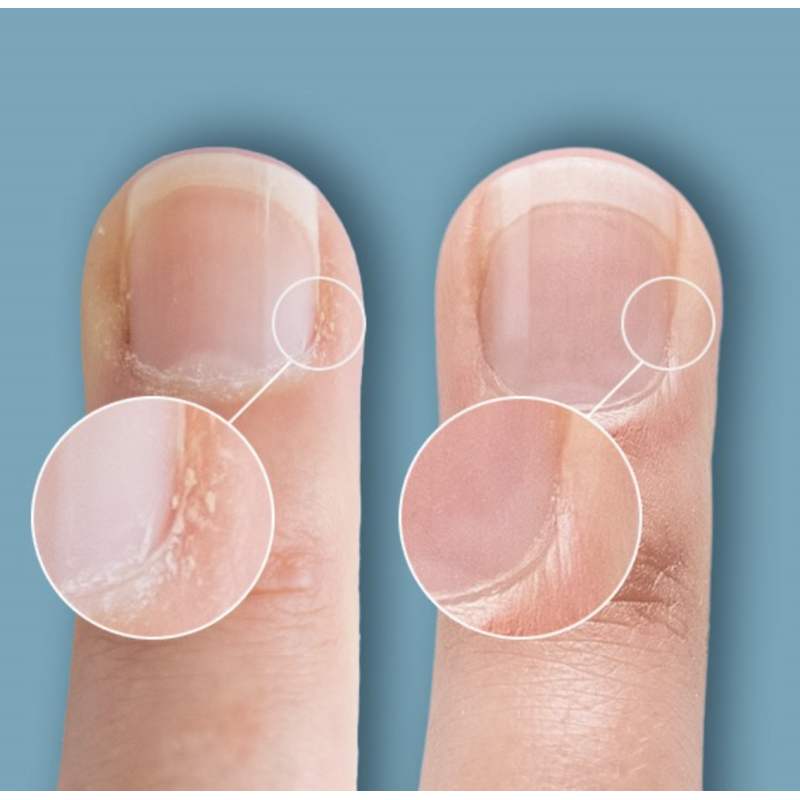 Cuticle Eraser - Cuticle Remover 15 ml CND-NAGELHAUTENTFERNER-Double Beauty Shop